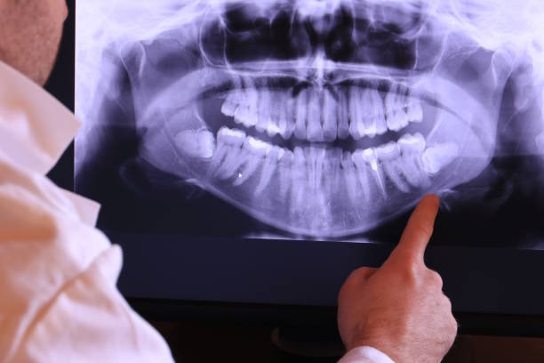 Best Emergency Treatment for Toothache in Bossier City, LA