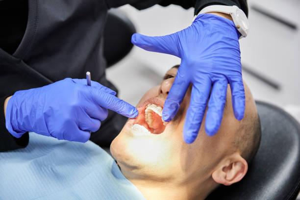 Best Emergency Tooth Extraction in Bossier City, LA